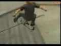 Skateboard Accident Compilation... Mashup Remix