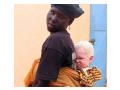 Negru albinos